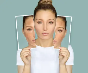 Cómo aclararse la piel en casa de forma natural