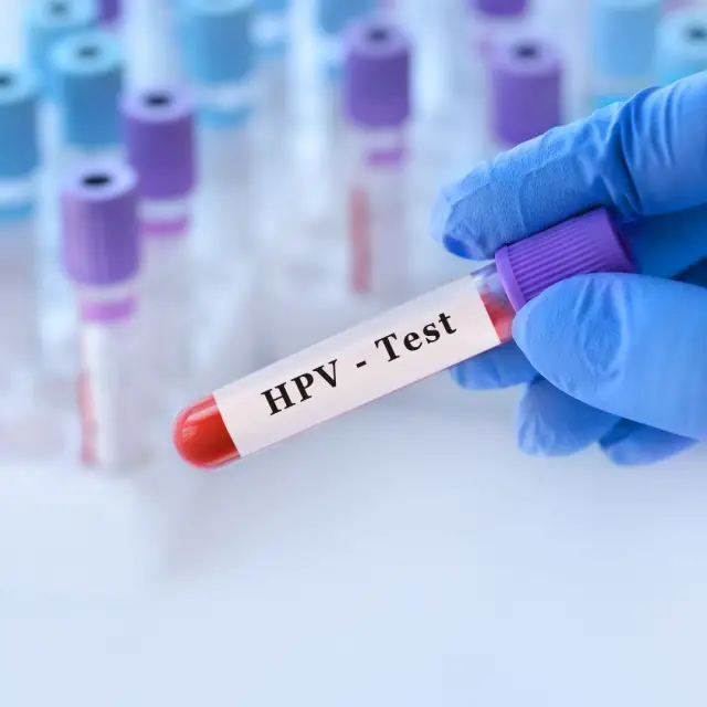 HPV Prevention in Colombia 2024 